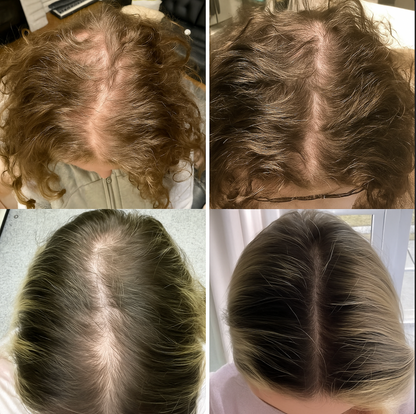 Natural Hair Growth Oil